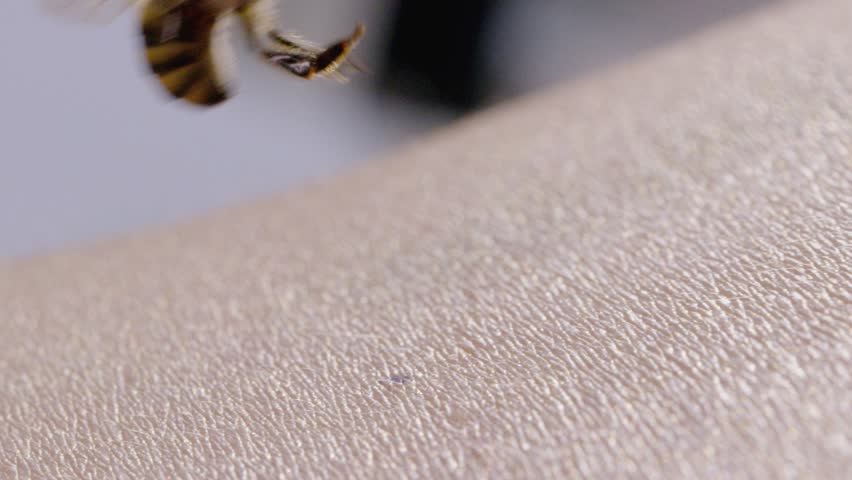 Honey Bee Stinging Human Skin with Visible Stinger Close Up Macro