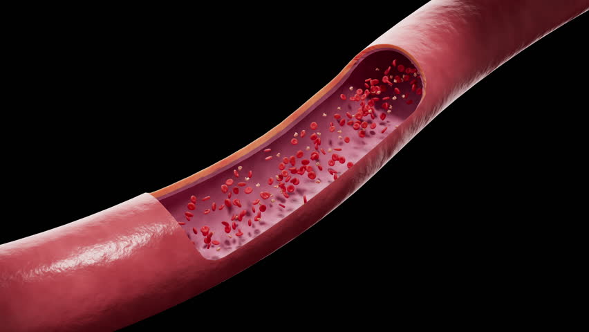 3D medical animation of red blood cells and cholesterol lipid particles flowing through a human artery