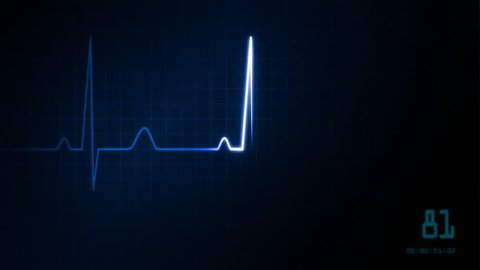 The graphic of EKG monitor
