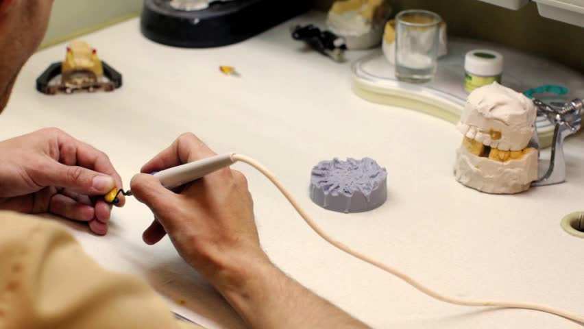 Dental implants laboratory. Dental technician working with wax seals, as a