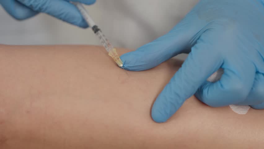 Gloved hands injecting a fine needle into small leg veins during vein treatment