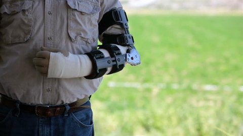 Medical surgical arm brace man in pain.Adjustable prosthetic arm brace rubs arm in pain after accident. Mechanical medical prosthesis, compression bandage glove used to stabilize elbow after surgery.