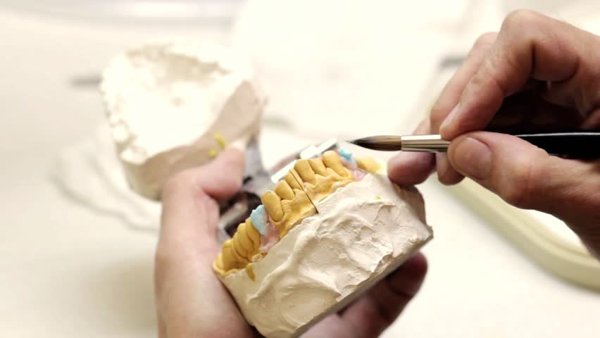 Dental implants laboratory. Dental implants (brushing)