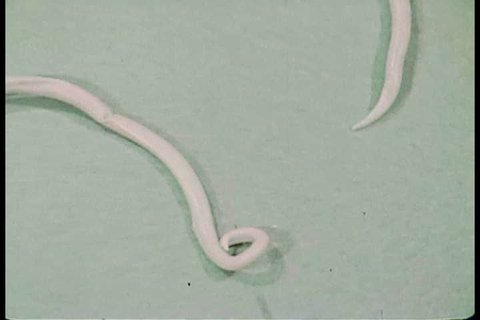 1960s - Parasitic worms infect children around the world.