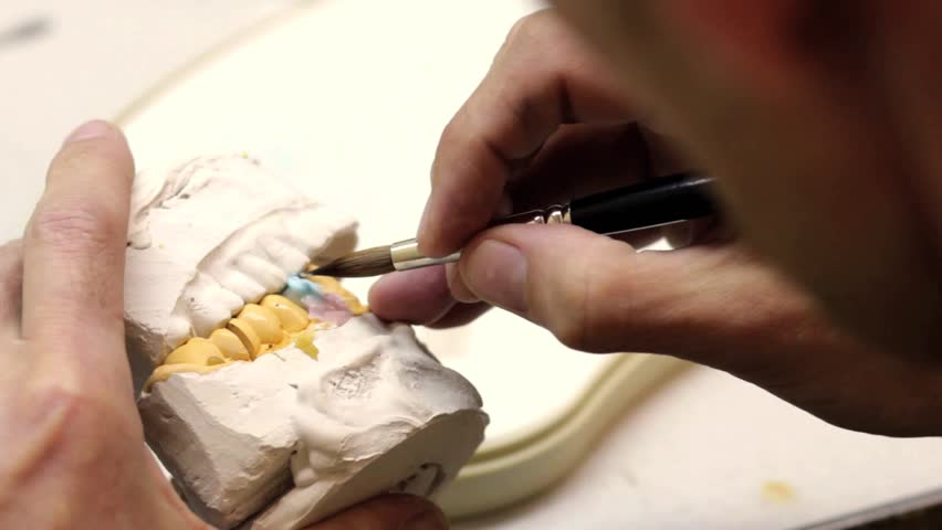 Dental implants (brushing)