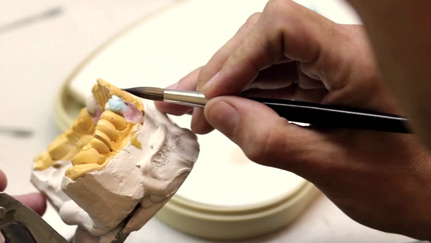 Dental implants (brushing)