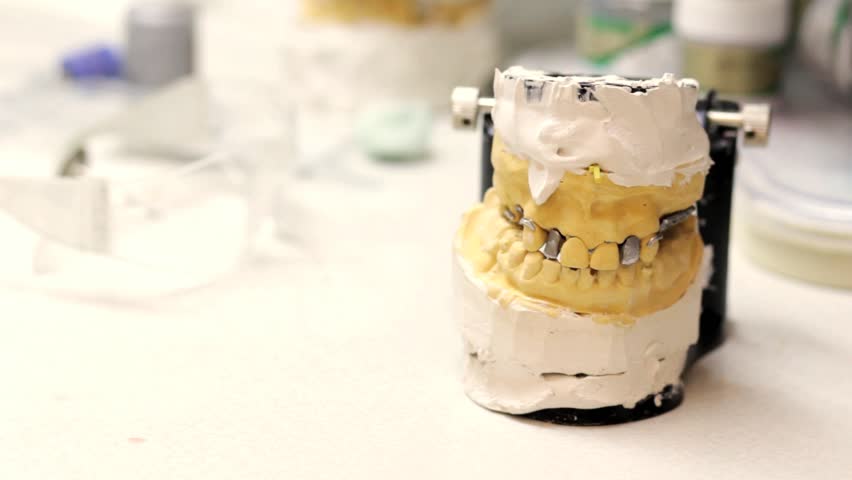 Dental technician workplace. Cast of a jaw.

