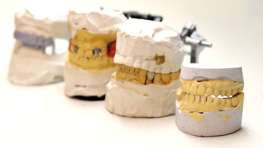 Dental technician workplace. Casts of a jaws.

