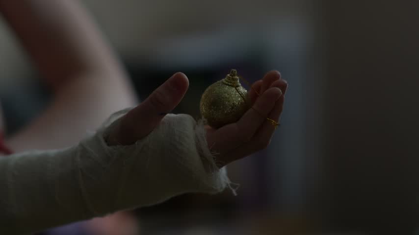 A close up of a teenagers hand in a plaster cast, holding a Christmas ornament for a Christmas or New Years tree.