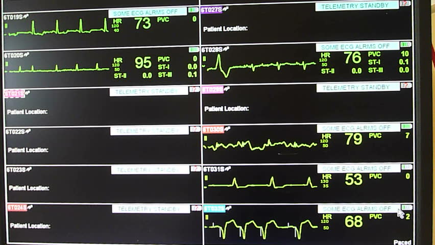 WASHINGTON HOSPITAL INTERIOR - CIRCA 2013: Monitor reads various vital signs in