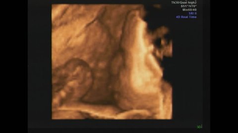 A 4d Ultrasound Of A Video De Stock 100 Libre De Droit Shutterstock