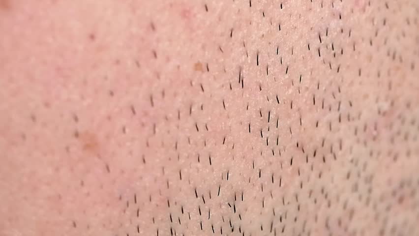 Macro shot of some human skin