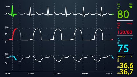 Animation of schematic Intensive Care Unit monitor showing normal values for vital signs, starting with cardiac frequency. Dark blue backgound.