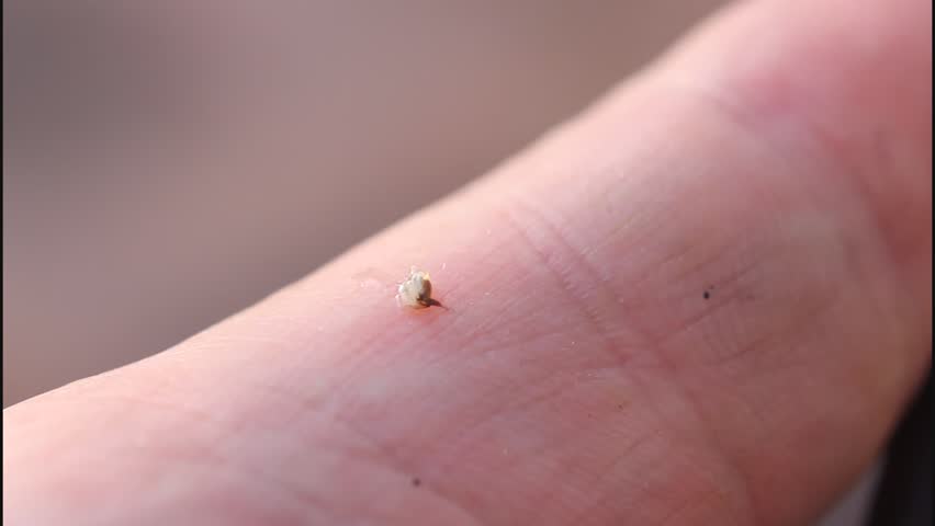 Bee Sting Left Body Alone Makes Stock Footage Video 100 Royalty Free 4368509 Shutterstock