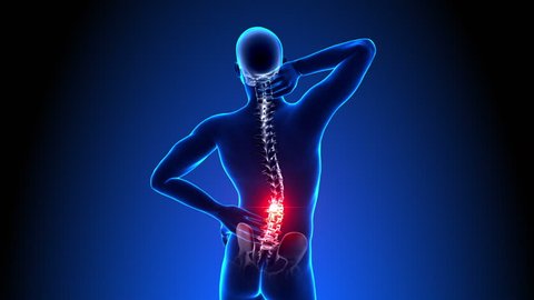 Hurt Spine - Male Backbone - Backache, Headache - Vertebrae Pain
