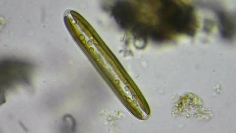 live diatom alga under microscope, magnification 1600x