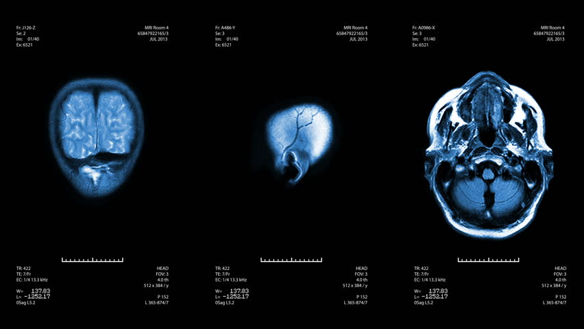 Three head views of MRI scan. Loopable. Blue.
See more color options in my portfolio. Royalty-Free Stock Footage #4412879