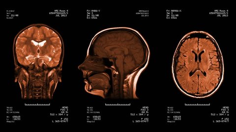 Three head views of MRI scan. Loopable. Amber.
See more color options in my portfolio.