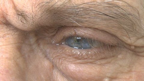 The eyes of an elderly man