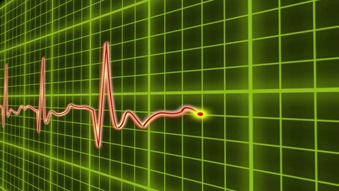 EKG cardio heart beat, normal and zero pulse with audio