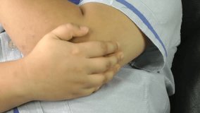Boy with allergy skin scratch itchy arm