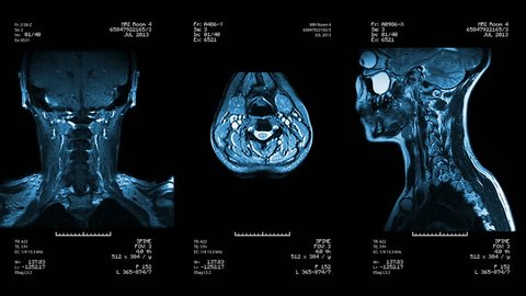 Three neck views of MRI scan. Loopable. Blue.
See more color options in my portfolio.