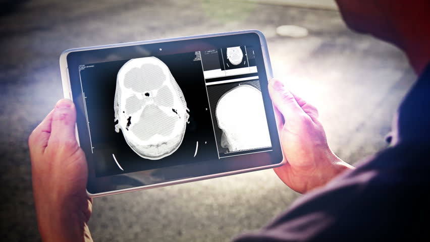 A doctor examines a head MRI scan on a tablet PC screen.