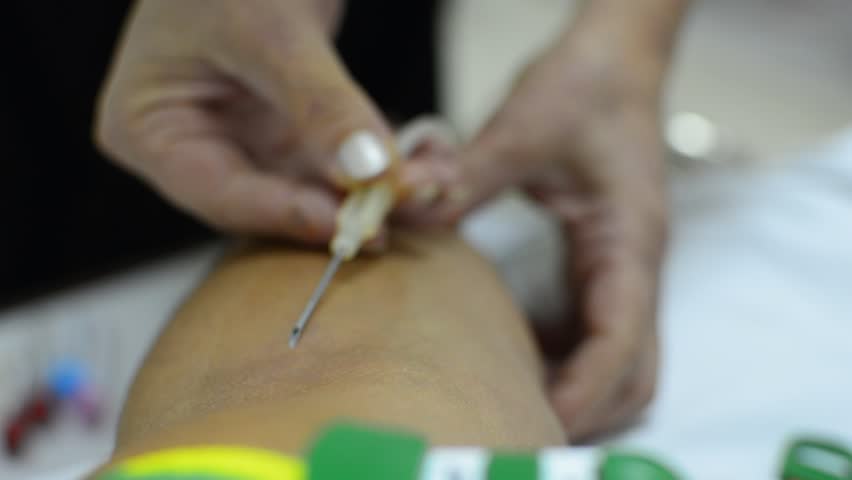 taking blood - Stock Video. Nurse inserts needle into blood donor's arm, taking