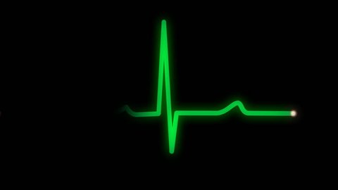 An animated heart monitor EKG line.  With sound and alpha matte.