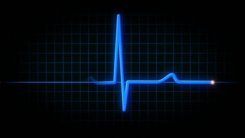 An animated heart monitor EKG line.  With sound and alpha matte.