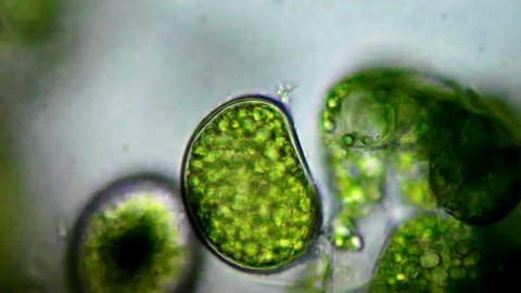 Seaweed (algae) under microscope, magnification 100X