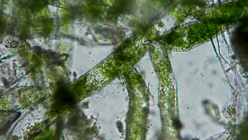 Seaweed (algae) Under Microscope, Magnification Stock Footage Video