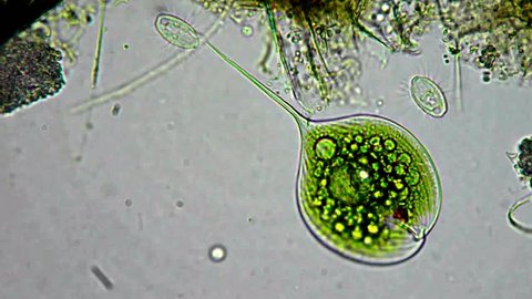 Live in a drop from pond (green cells) under microscope, magnification 200X