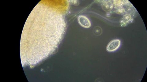 Bacterial cells motion under microscope (phase-contrast method of microscopy)