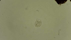 Full HD. Original video of tiny single celled vorticella under microscope 