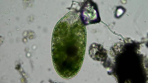 Real video of cilia motion of live cell (infusoria) with simbiontic green bacteria (microcystis aeruginosa) which lives in infusoria and gives it food by photosynthesis