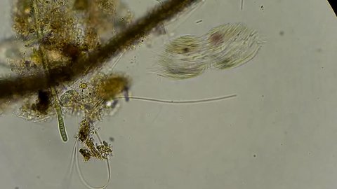 Full HD. Motion of single-celled animals (infusoria) under microscope