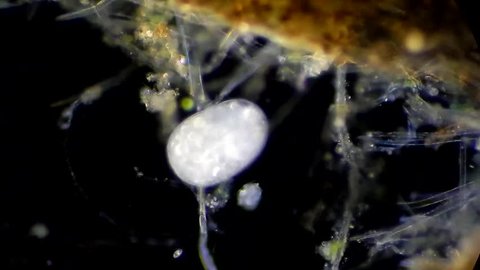 Full HD. Motion of single-celled animals (infusoria) under microscope