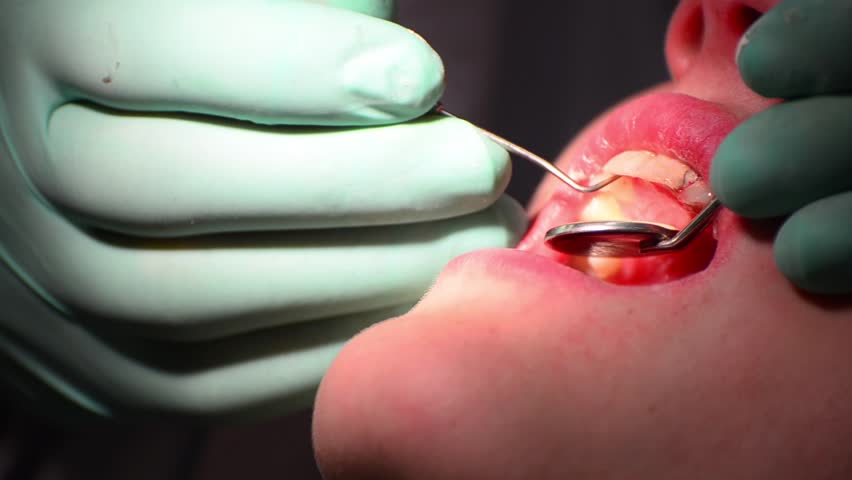 dentist check gum for gingivitis decease