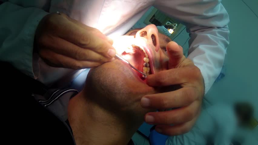 dentist treatment. Filling application. POV