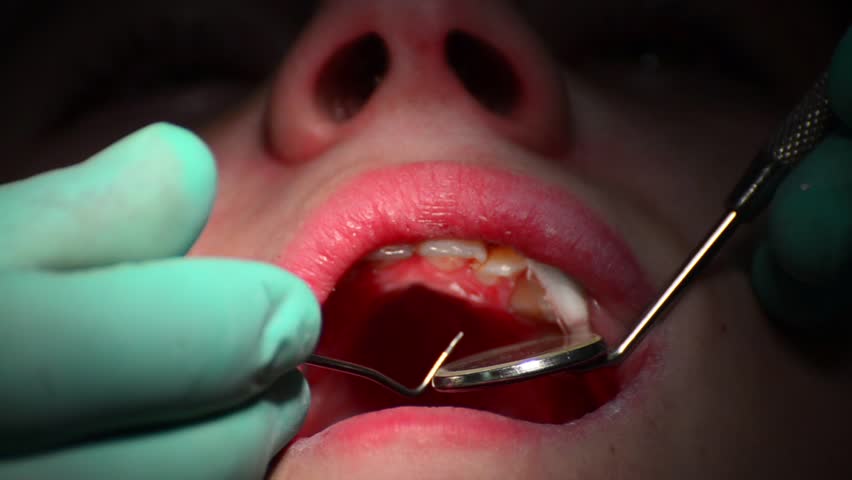 dentist teeth checkup and fix, close up