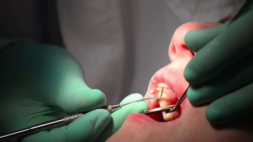 dentist do teeth check up