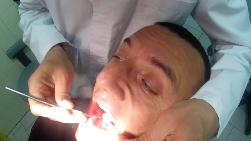 dentist teeth check up for gum gingivitis and tooth caries