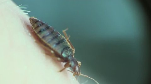 Bedbug sitting on human skin