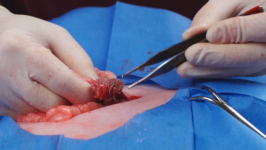 Veterinarian identifies an abdominal obstruction in cat. Surgical removal of