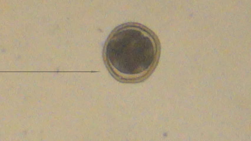 Veterinarian looking at Roundworm Egg (Toxocara canis) under microscope at 400x