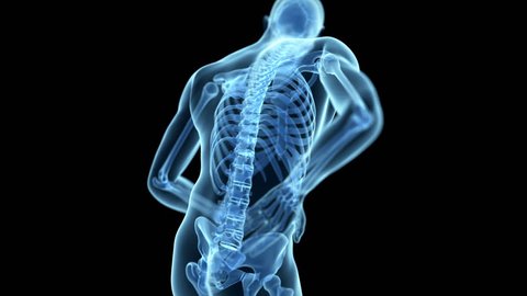 medical animation of a man having a backache