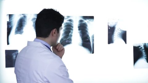 Handsome Young Male Doctor Looking at Xray Diagnose