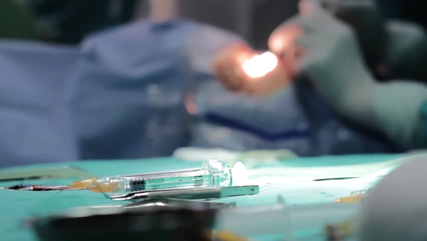 Cataract surgery.Surgeons team performing operation.Surgeon operating eye cataract,wearing protective gloves,hands close up.Shallow depth of field.Patient close up face. Royalty-Free Stock Footage #5550494