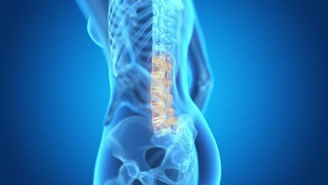 x-ray style - medical 3d animation of a female having acute pain in the back 